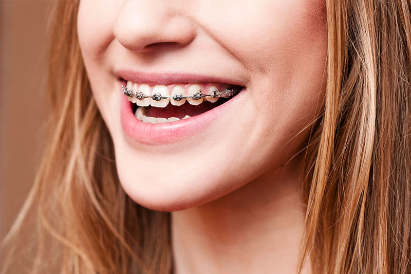 Orthodontics in Cedar Rapids